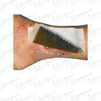 پانسمان جاذب کربن فعال ویلیواکتیو نقره لوهمن روشه